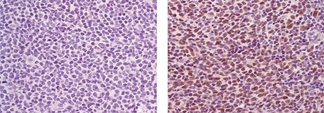 Mouse IgG1 kappa Isotype Control in Immunohistochemistry (Paraffin) (IHC (P))