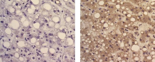 Mouse IgG1 kappa Isotype Control in Immunohistochemistry (Paraffin) (IHC (P))