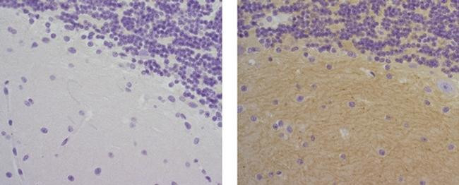 Mouse IgG1 kappa Isotype Control in Immunohistochemistry (Paraffin) (IHC (P))