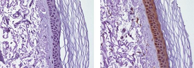 Mouse IgG2b kappa Isotype Control in Immunohistochemistry (Paraffin) (IHC (P))