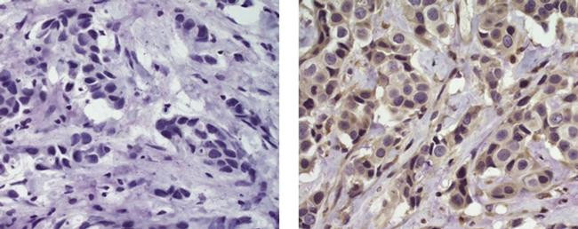 Mouse IgG2b kappa Isotype Control in Immunohistochemistry (Paraffin) (IHC (P))