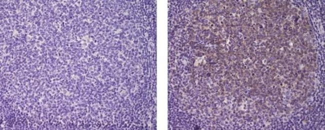 AID Antibody in Immunohistochemistry (Paraffin) (IHC (P))