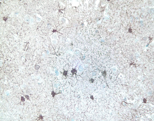 ERK1/ERK2 Antibody in Immunohistochemistry (IHC)