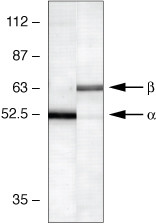 CaMKII alpha Antibody in Western Blot (WB)