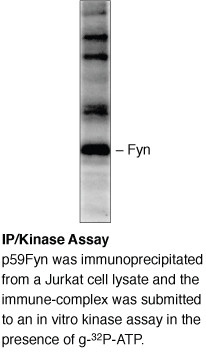 Fyn Antibody in Western Blot (WB)