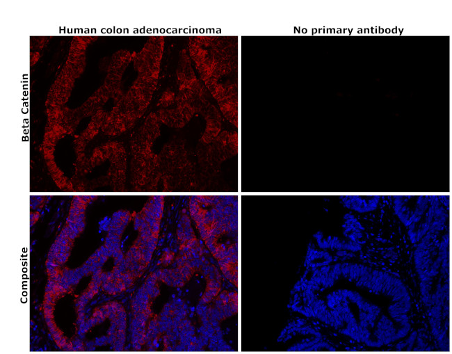 beta Catenin Antibody in Immunohistochemistry (Paraffin) (IHC (P))