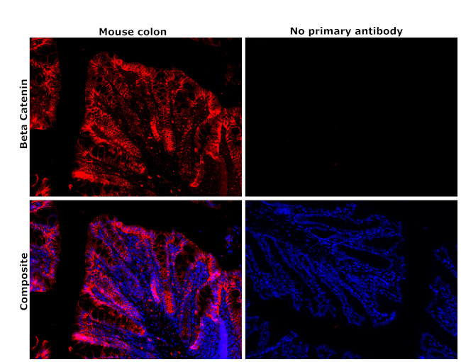 beta Catenin Antibody in Immunohistochemistry (Paraffin) (IHC (P))