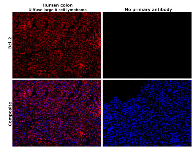 Bcl-2 Antibody in Immunohistochemistry (Paraffin) (IHC (P))