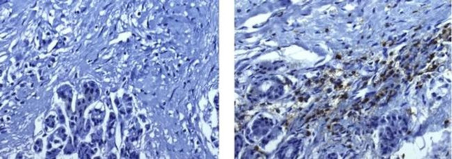 CD45 Antibody in Immunohistochemistry (Paraffin) (IHC (P))