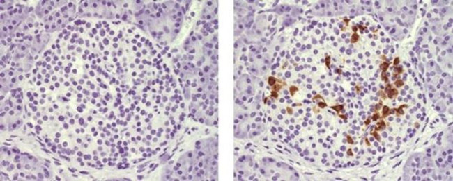 Somatostatin Antibody in Immunohistochemistry (Paraffin) (IHC (P))