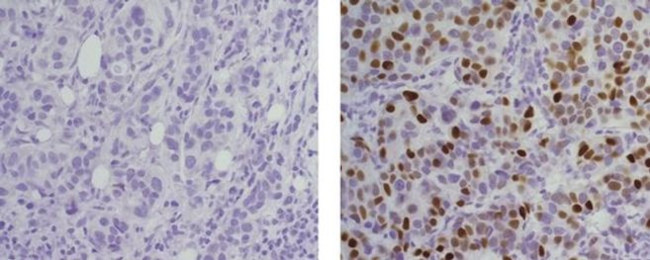 Progesterone Receptor Antibody in Immunohistochemistry (Paraffin) (IHC (P))