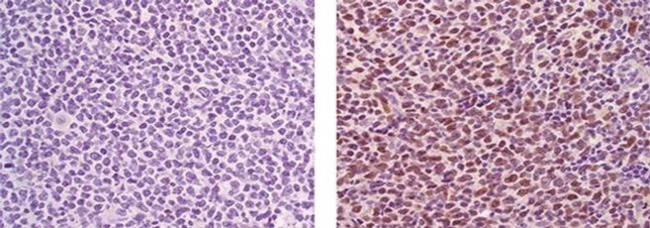 SOX11 Antibody in Immunohistochemistry (Paraffin) (IHC (P))