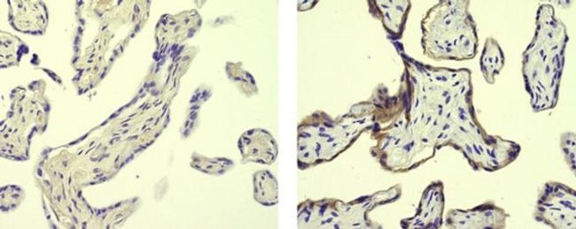 Placental Alkaline Phosphatase Antibody in Immunohistochemistry (Paraffin) (IHC (P))