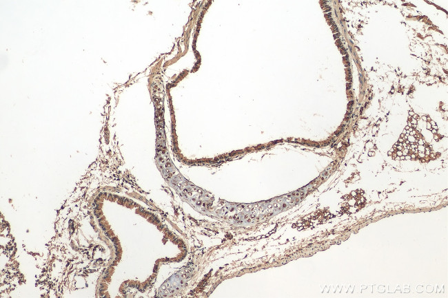 CRTAC1 Antibody in Immunohistochemistry (Paraffin) (IHC (P))