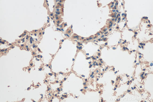 CRTAC1 Antibody in Immunohistochemistry (Paraffin) (IHC (P))