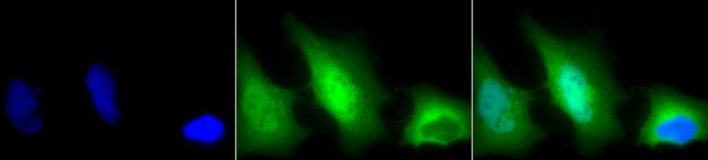 Superoxide dismutase (SOD) Cu/Zn Antibody in Immunocytochemistry (ICC/IF)