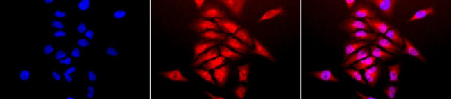 Superoxide dismutase (SOD) Cu/Zn Antibody in Immunocytochemistry (ICC/IF)