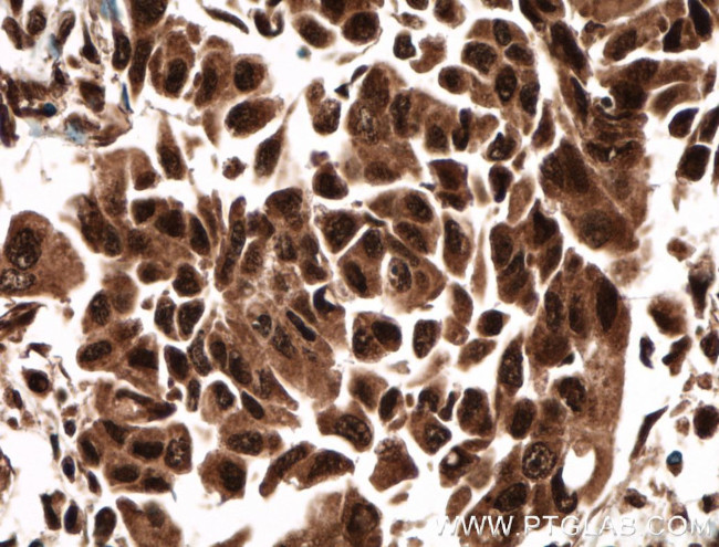 CUGBP1 Antibody in Immunohistochemistry (Paraffin) (IHC (P))