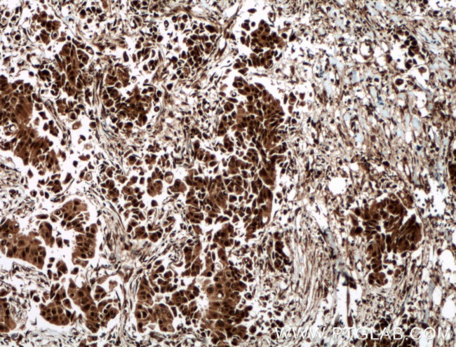 CUGBP1 Antibody in Immunohistochemistry (Paraffin) (IHC (P))