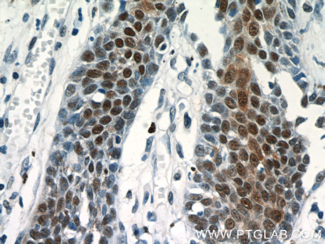 CUGBP1 Antibody in Immunohistochemistry (Paraffin) (IHC (P))