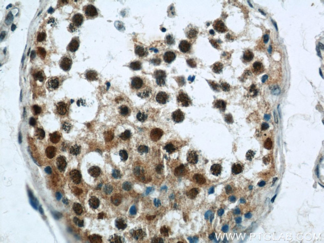 CUGBP1 Antibody in Immunohistochemistry (Paraffin) (IHC (P))