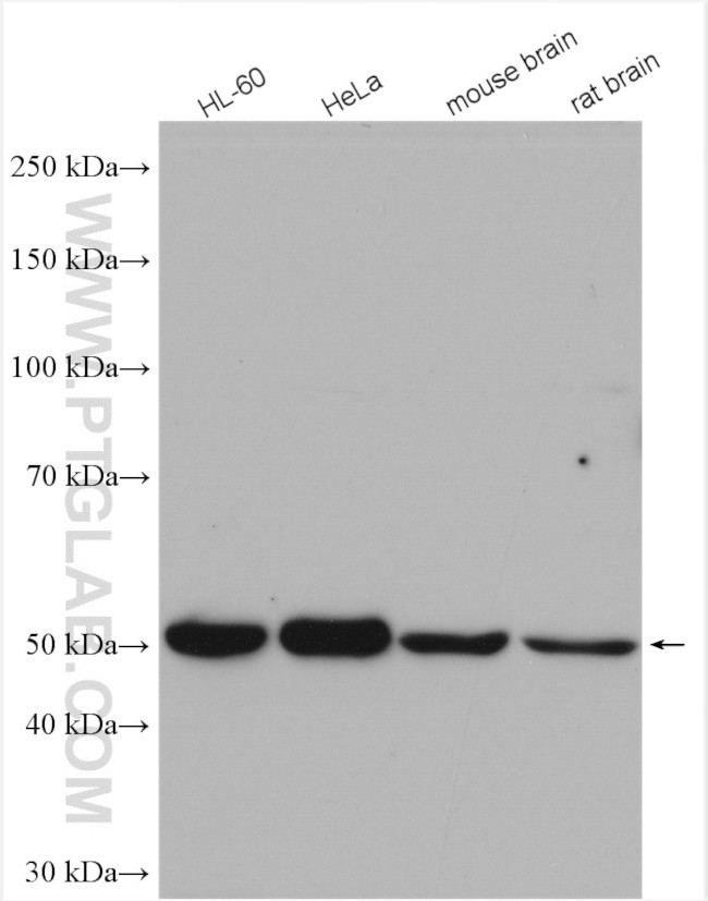 CUGBP1 Antibody in Western Blot (WB)