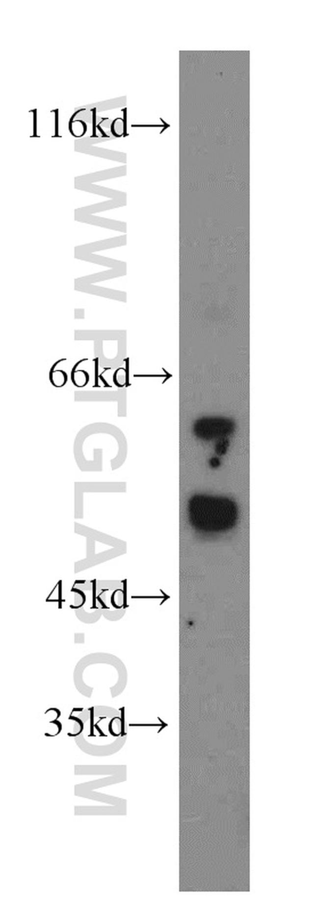 CUGBP1 Antibody in Western Blot (WB)