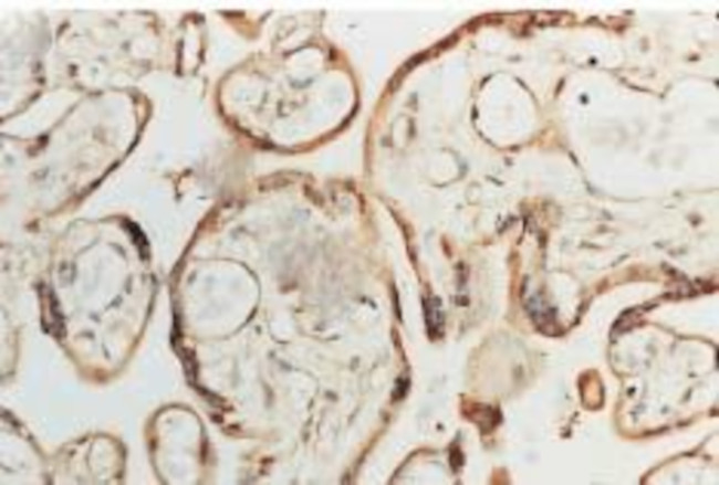 Superoxide dismutase (SOD) Cu/Zn Antibody in Immunohistochemistry (IHC)