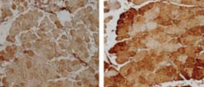 Superoxide dismutase (SOD) Mn Antibody in Immunohistochemistry (IHC)