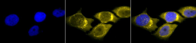 Superoxide dismutase (SOD) Mn Antibody in Immunocytochemistry (ICC/IF)