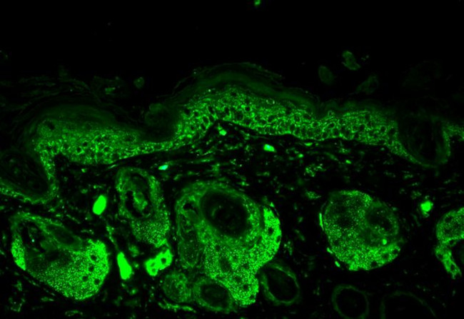 Superoxide dismutase (SOD) Mn Antibody in Immunohistochemistry (IHC)