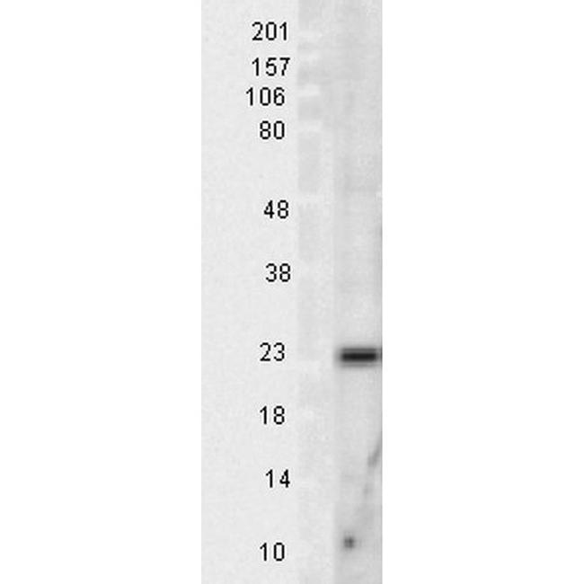 Superoxide dismutase (SOD) Mn Antibody in Western Blot (WB)