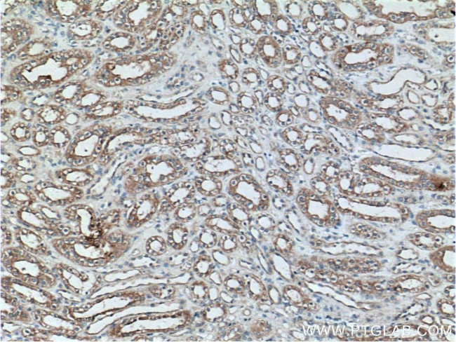 PTPRS Antibody in Immunohistochemistry (Paraffin) (IHC (P))