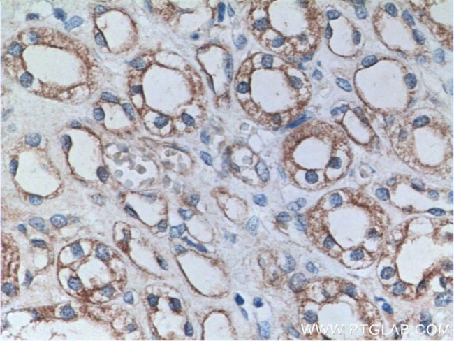 PTPRS Antibody in Immunohistochemistry (Paraffin) (IHC (P))