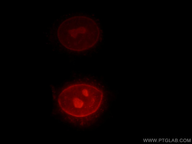 RPIA Antibody in Immunocytochemistry (ICC/IF)