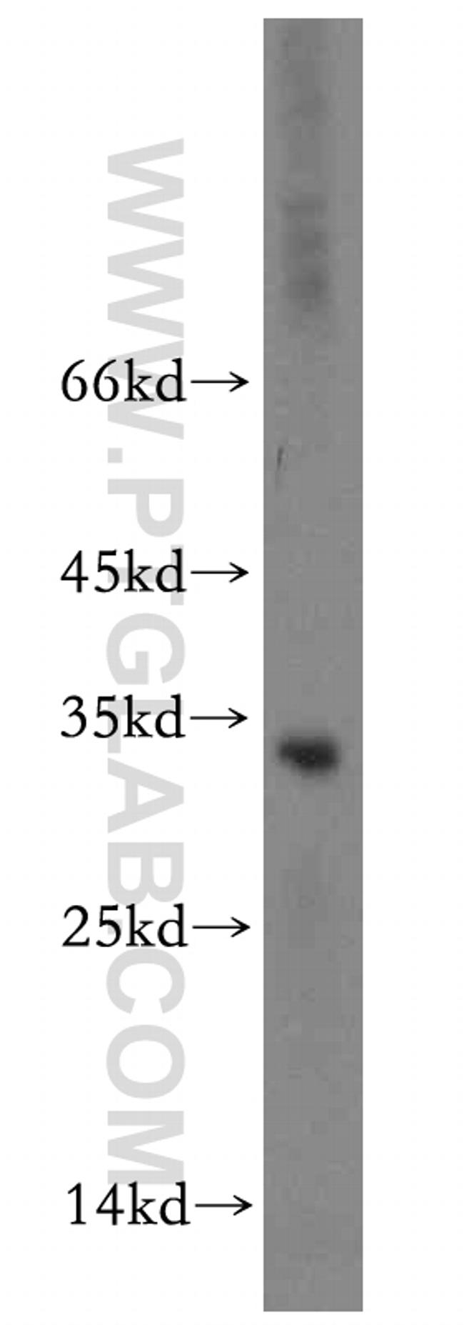 RPIA Antibody in Western Blot (WB)