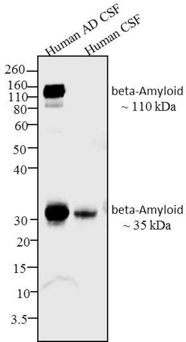 beta Amyloid Antibody