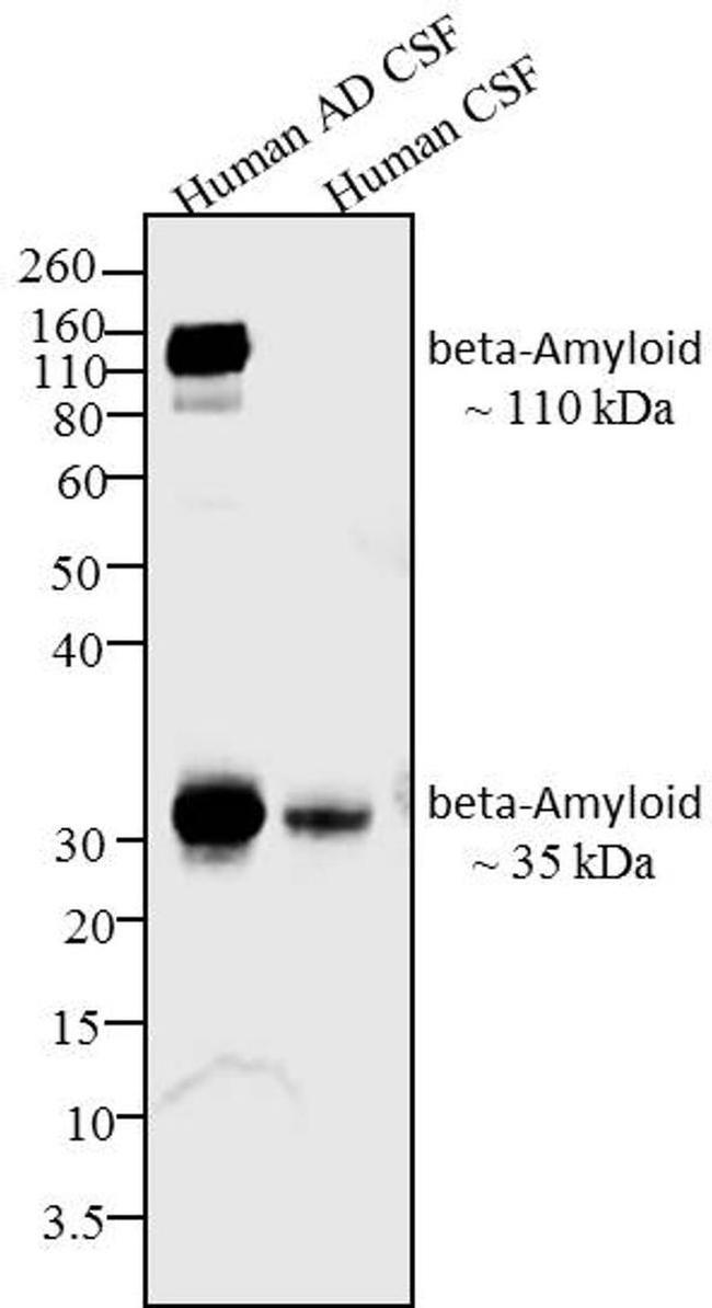 beta Amyloid Antibody in Western Blot (WB)