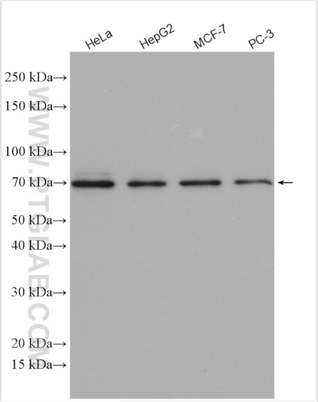 ETV5 Antibody in Western Blot (WB)