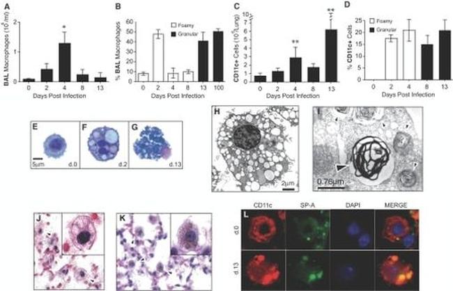 CD11c Antibody in Immunohistochemistry (IHC)