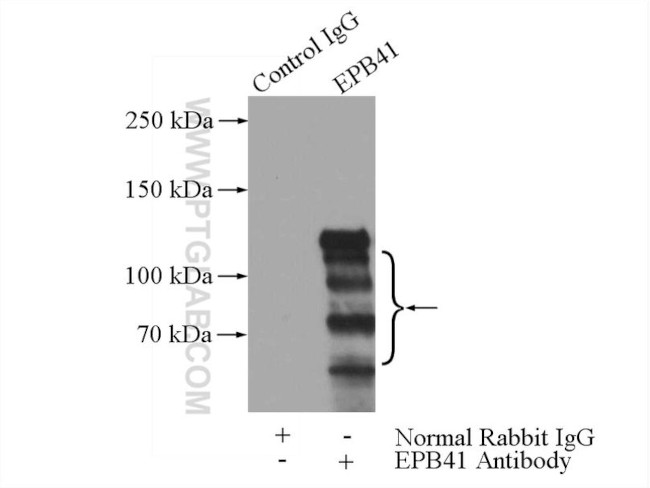 EPB41 Antibody in Immunoprecipitation (IP)