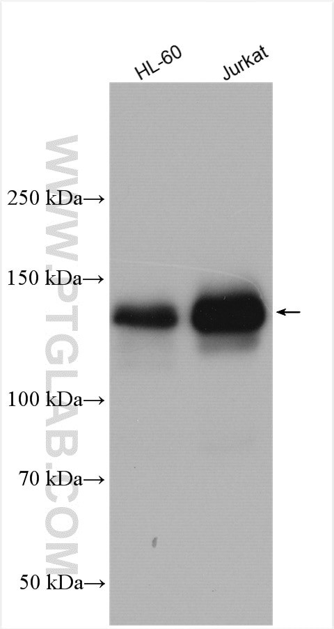 EPB41 Antibody in Western Blot (WB)