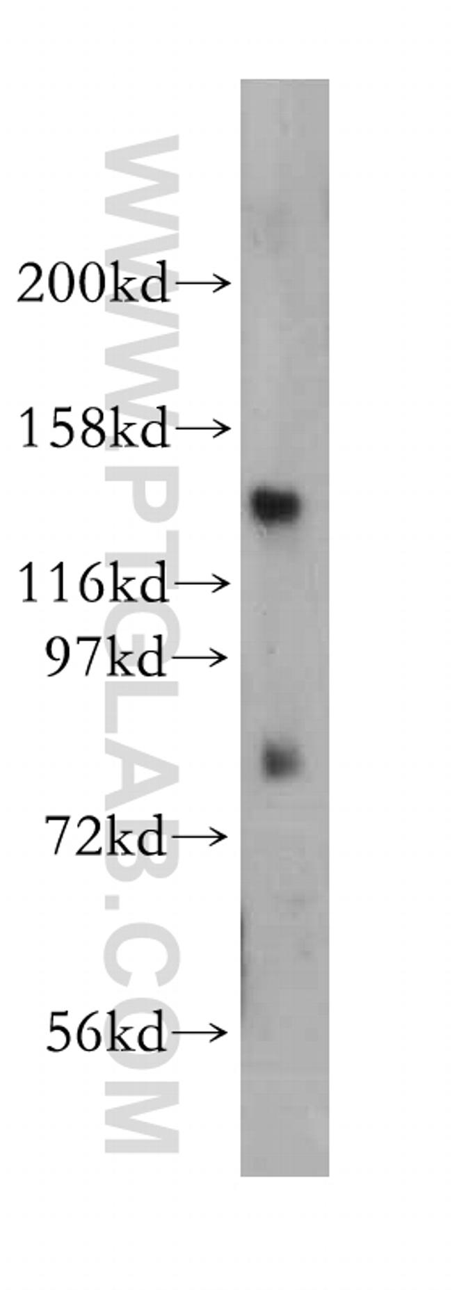 EPB41 Antibody in Western Blot (WB)