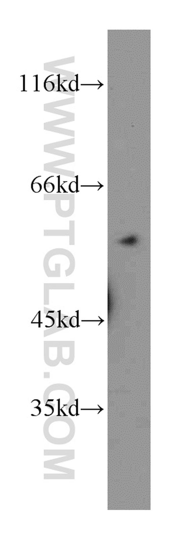 DBNL Antibody in Western Blot (WB)