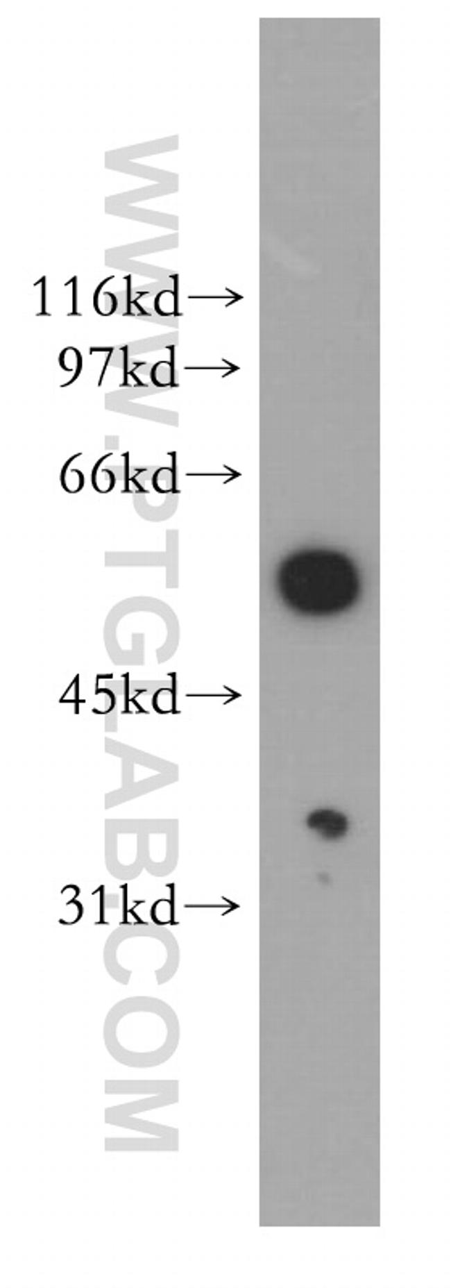 DBNL Antibody in Western Blot (WB)