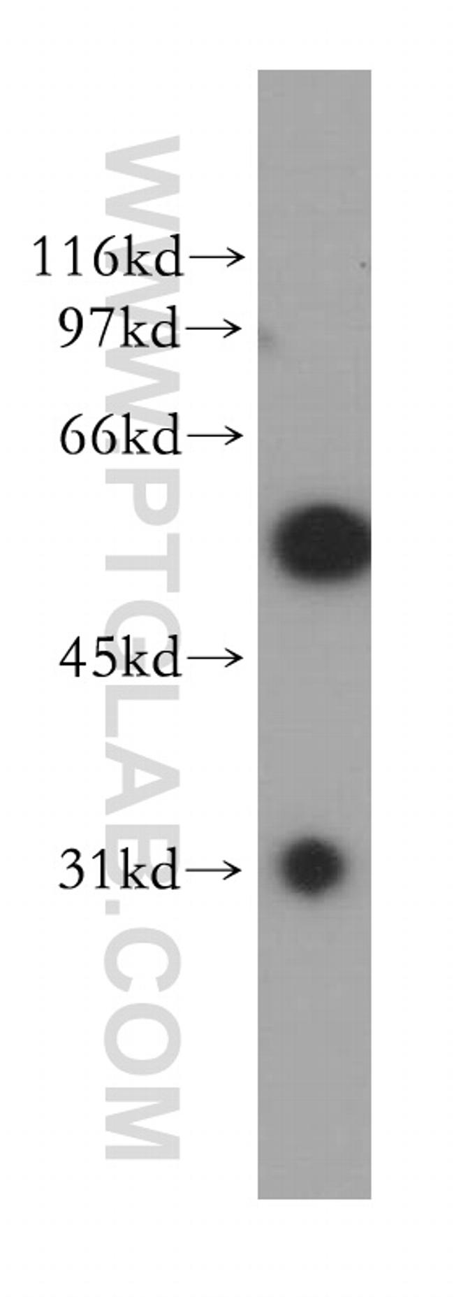 DBNL Antibody in Western Blot (WB)