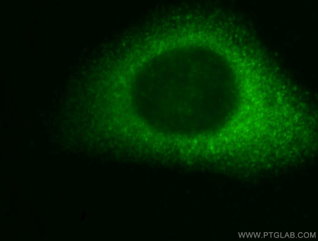 DBNL Antibody in Immunocytochemistry (ICC/IF)