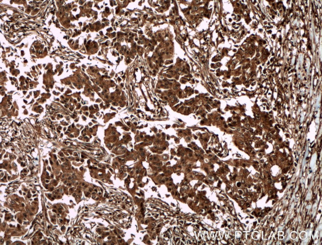 DBNL Antibody in Immunohistochemistry (Paraffin) (IHC (P))