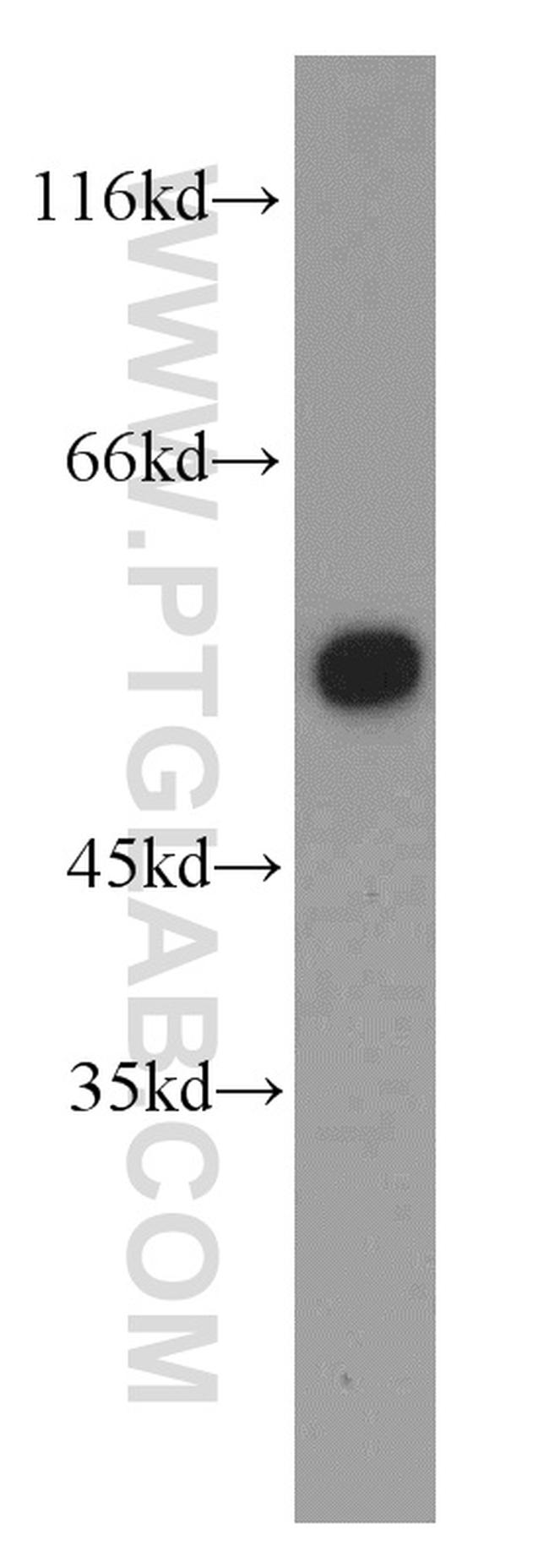 DBNL Antibody in Western Blot (WB)