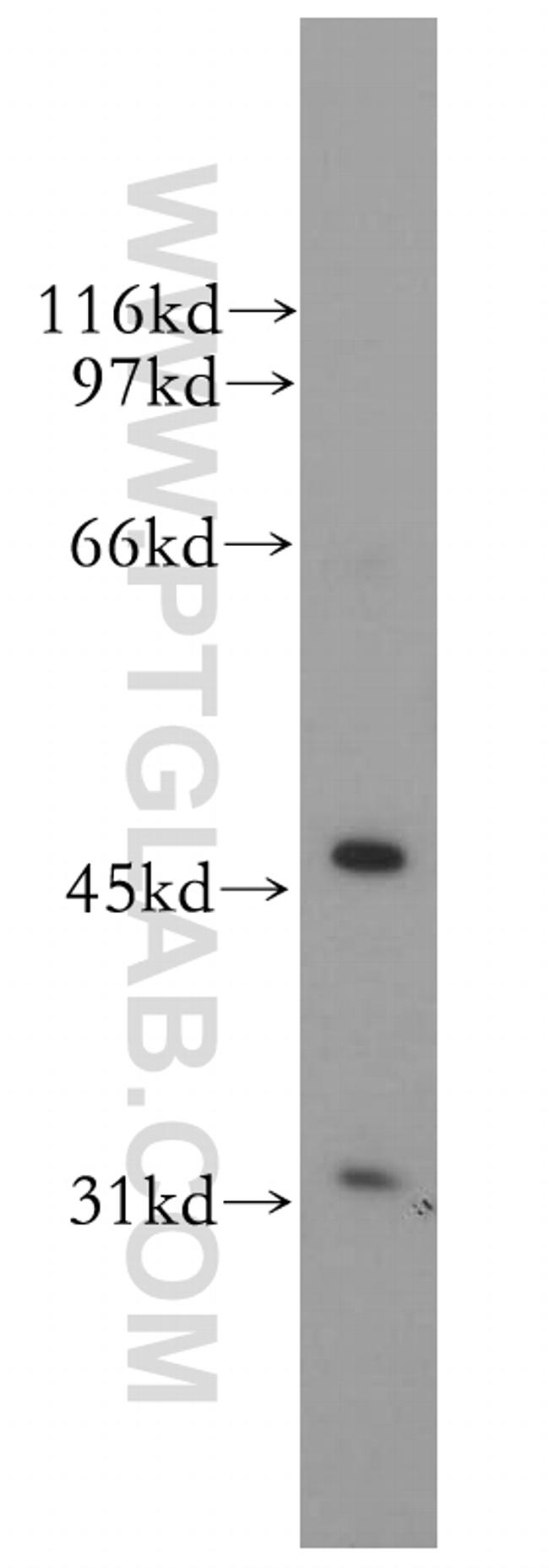 TFAP2A/AP-2 Antibody in Western Blot (WB)